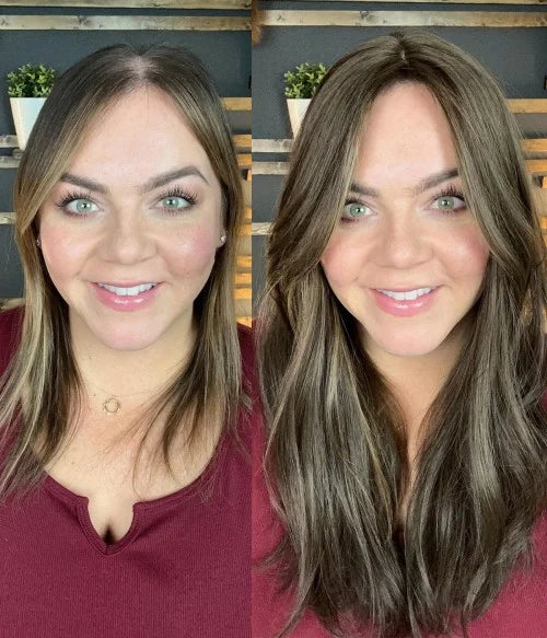 7.5” x 7.5” Upgrade Aura Skin Top Human Hair Topper