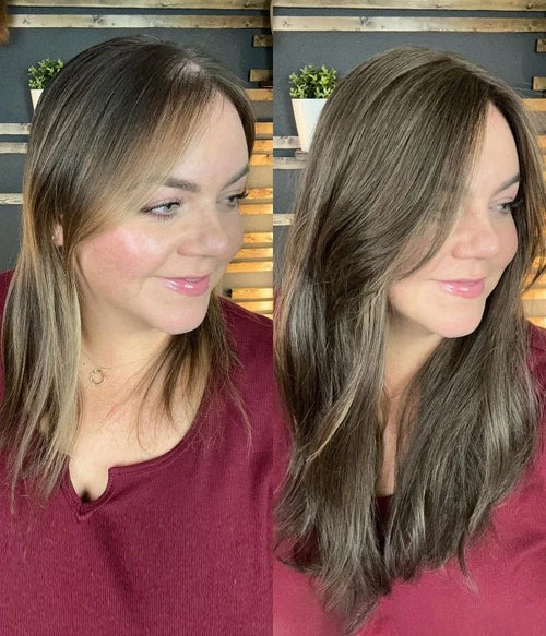 7.5” x 7.5” Upgrade Aura Skin Top Human Hair Topper