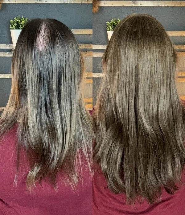 7.5” x 7.5” Upgrade Aura Skin Top Human Hair Topper
