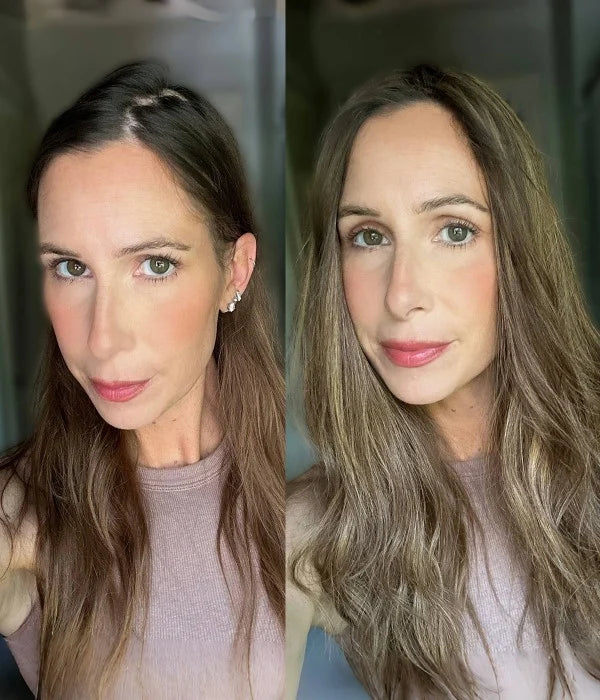 7.5” x 7.5” Upgrade Aura Skin Top Human Hair Topper