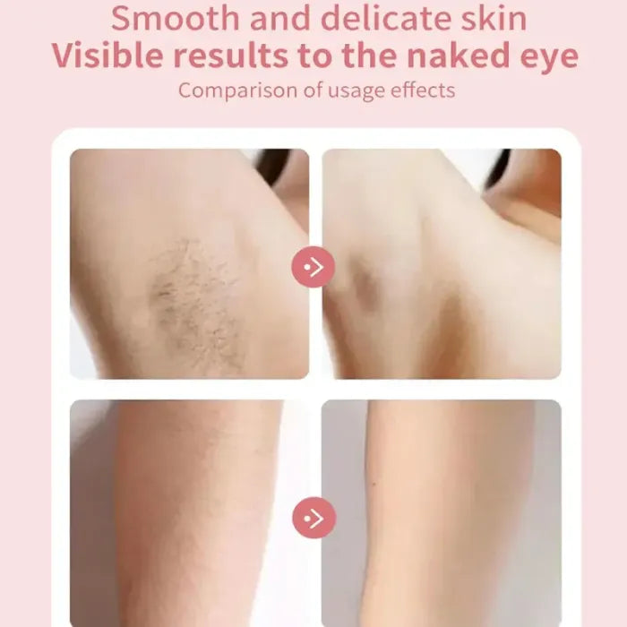 Best Silk Glide Razor, Lady Shaver, Silk Glide Epilator Painless Hair Removal at Home, 2 in 1 Electric Shaver Razors for Women, for Sensitive Skin, Wet & Dry